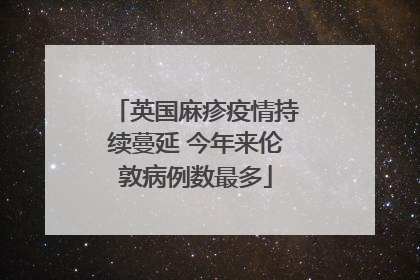 英国麻疹疫情持续蔓延 今年来伦敦病例数最多